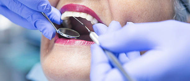 Best Emergency Cosmetic Dentistry (e.g., broken veneers) in Fort Washington, MD